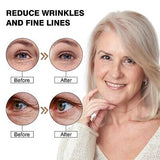 Eye Device for Wrinkles | Under Eye Bags | Eye Puffiness - 2 in 1 Eye Wrinkle...